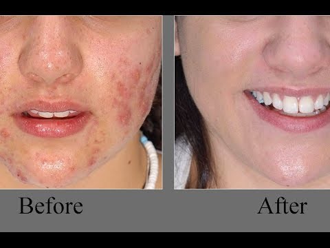 Josie Maran 100% Pure Argan Organic Moisturising Oil – Bild 4