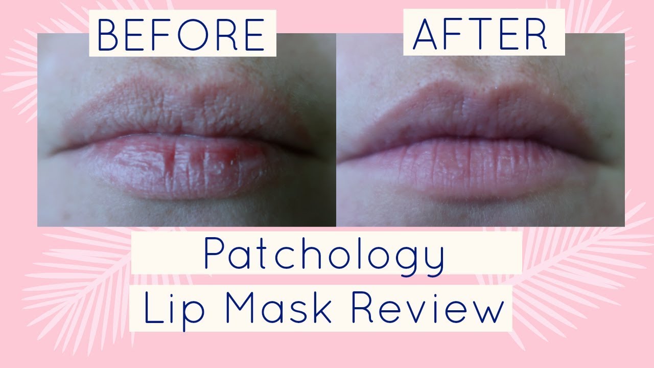 Patchology MoodPatch Keep Smiling Lips Gels Patches – Bild 4