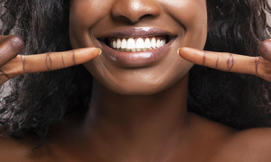 MOON Oral Care By Kendell Jenner Kendall Jenner Teeth Whitening Pen – Bild 4